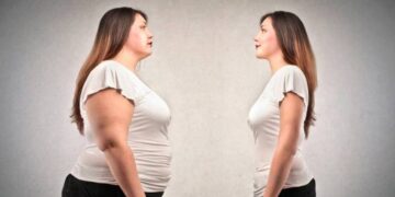 ΠΑΧΥΣΑΡΚΙΑ – Νέες απόψεις για ένα αυξανόμενο πρόβλημα